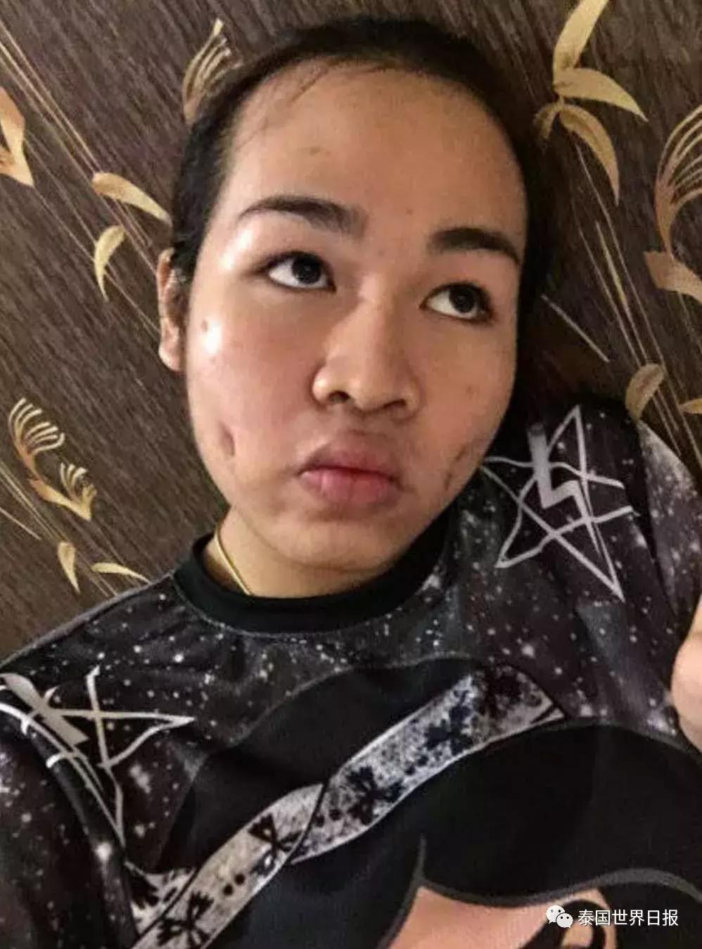 泰国网红Pond妹5年整容史:隆鼻、纹眉、凸魔唇