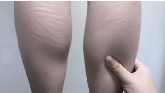 爱生气、胸闷气短？可以按揉小腿上的“理气穴”顺气提神