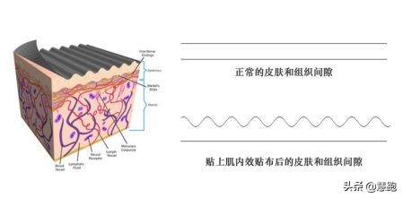 室内运动防护措施,跑步运动防护小知识大全