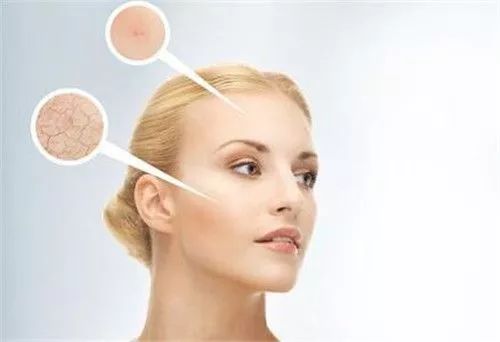 为什么涂护肤品会火辣辣的感觉,为什么涂护肤品脸会刺痛红肿