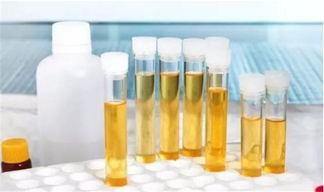 尿液提炼黄金,为了提炼黄金煮沸5000升尿液科普