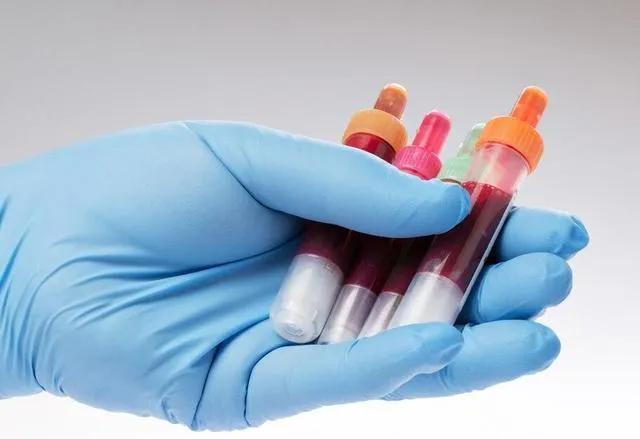 试管检查血沉有什么用,试管查血值需要空腹吗