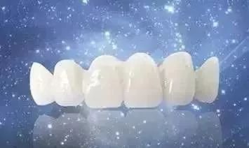 全瓷牙冠在保质期可以免费重做吗,全瓷牙冠价格表2021款报价