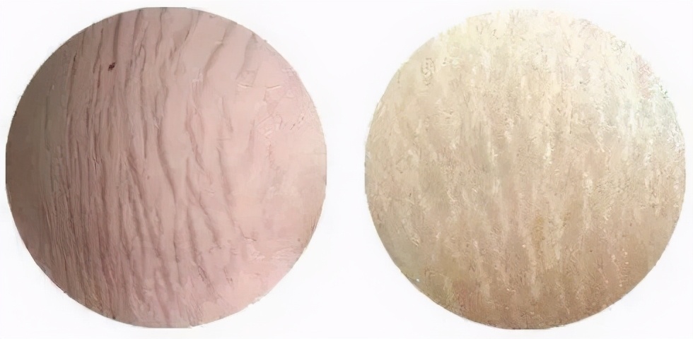 为什么我明明不胖看起来却很胖,不算特别胖但是长特别多的肥胖纹