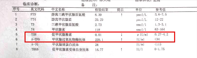 甲亢相关案例视频,亚临床甲亢怎样快速自愈