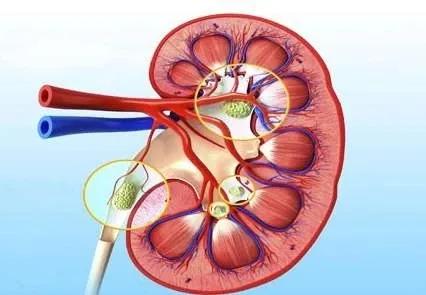 医疗科技最新突破人工肾,医学技术泌尿系统