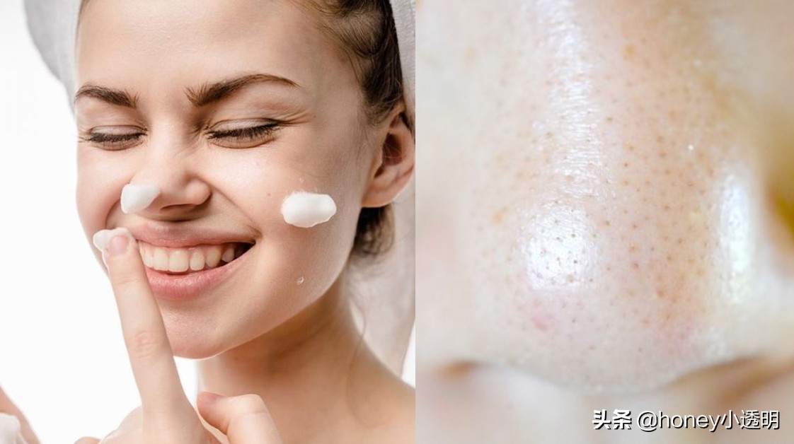 收缩毛孔精华液改善毛孔粗大,毛孔粗大用什么收缩毛孔精华