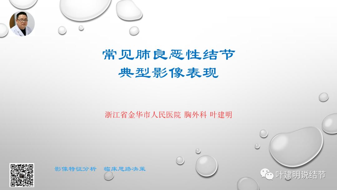 叶建明谈肺实性小结节视频,廖正银教授谈肺结节