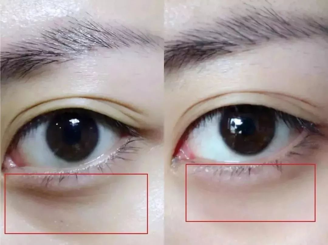 口罩一戴素面朝天,口罩一戴立马漂亮