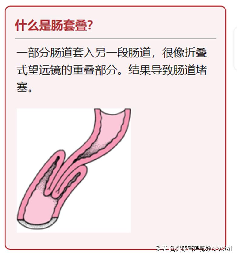 儿童突然肚子疼拉肚子是肠套叠吗,孩子肠胃炎后经常腹痛怎么回事