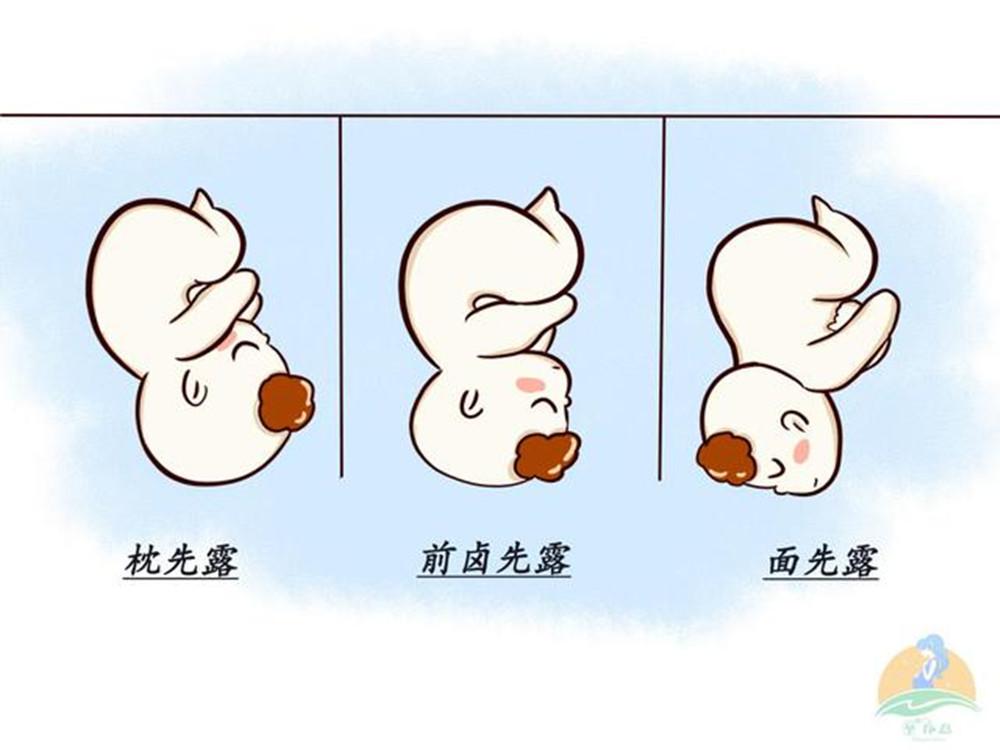 胎位不正怎么纠正最快注意事项,胎位不正怎么纠正最快海南