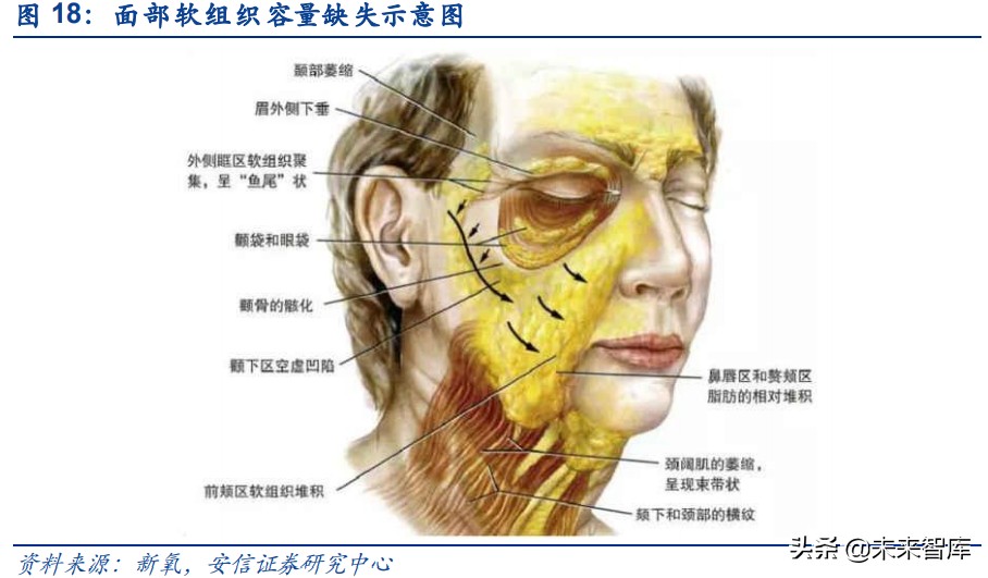 胶原蛋白是未来医美行业主赛道,胶原蛋白肽饮品行业报告