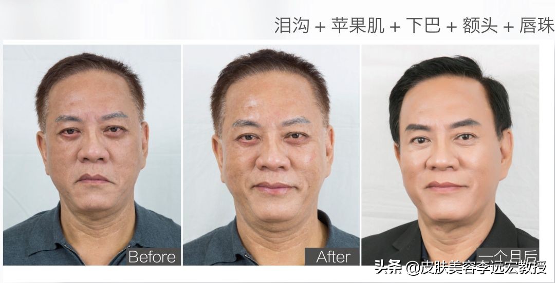 哪种口服胶原蛋白效果好,口服胶原蛋白的骗局