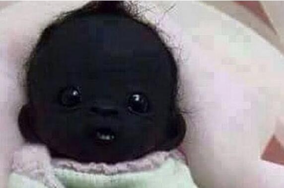 世上最黑的孩子现在怎么样了,世界最黑的小孩现在什么样了