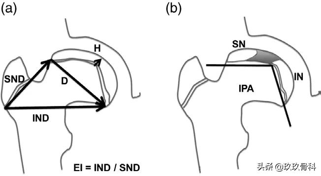 髋膝关节文献精译荟萃