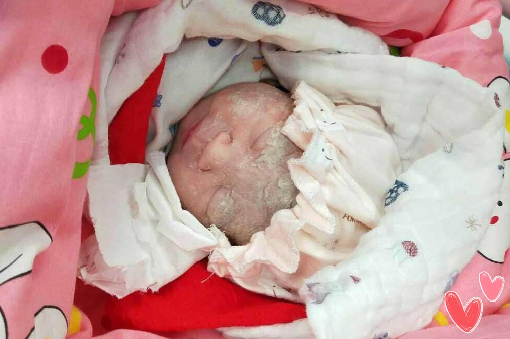 生下来丑宝宝怎么办,刚生出来的宝宝真丑