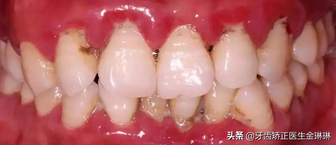 淄博诺尔漫口腔医院电话,淄博诺尔漫齿科