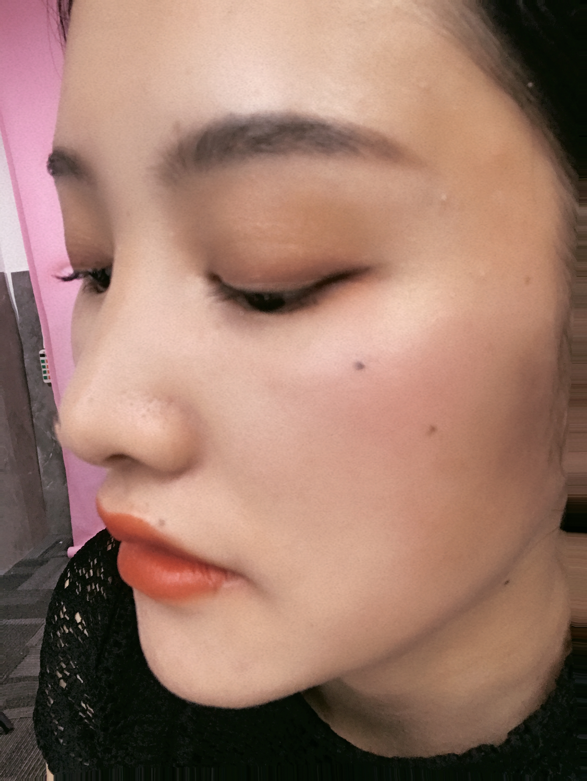 做了埋线双眼皮后悔了,做完双眼皮后悔的多吗