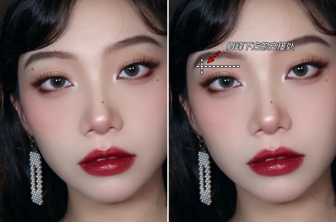 点痣就能变美,点痣整容大法