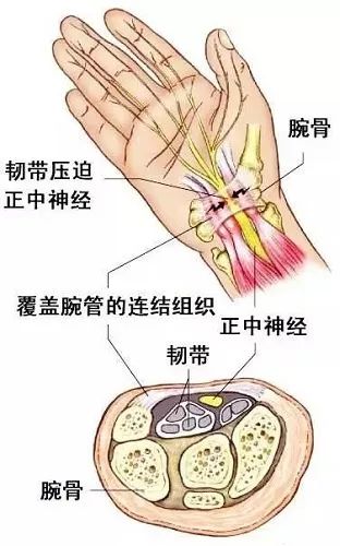 手部工作劳累麻疼怎么办,鼠标手手指发麻如何治疗