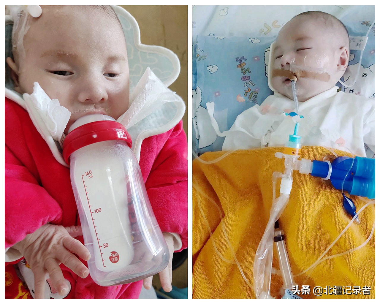 刚出生婴儿从鬼门关救回,宝宝一出生就被抢救