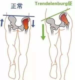 臀部不饱满，走路屁股摇来摇去？这块肌肉你一定要加强