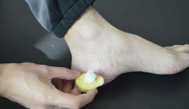 脚后跟干裂开口子吃什么维生素,脚后跟干裂是缺乏什么吗