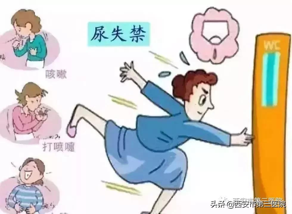 【盆底功能康复治疗】关爱女性盆底健康远离女性“社交癌”