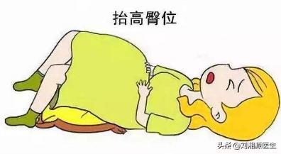 免疫治疗不良妊娠的方法,妊娠合并宫颈机能不全什么原因