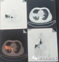 怎么应用统计学做调查,统计学方法可以解决的主要问题