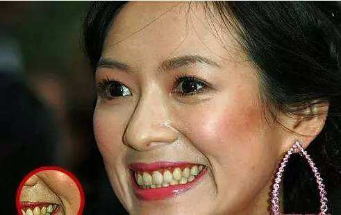 高伟光同款牙刷,高伟光牙刷介绍