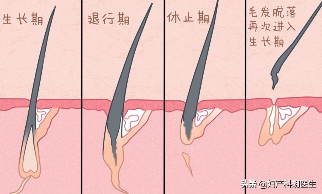 女性脱发因为气血虚产后脱发,秋风扫落叶怎么回事
