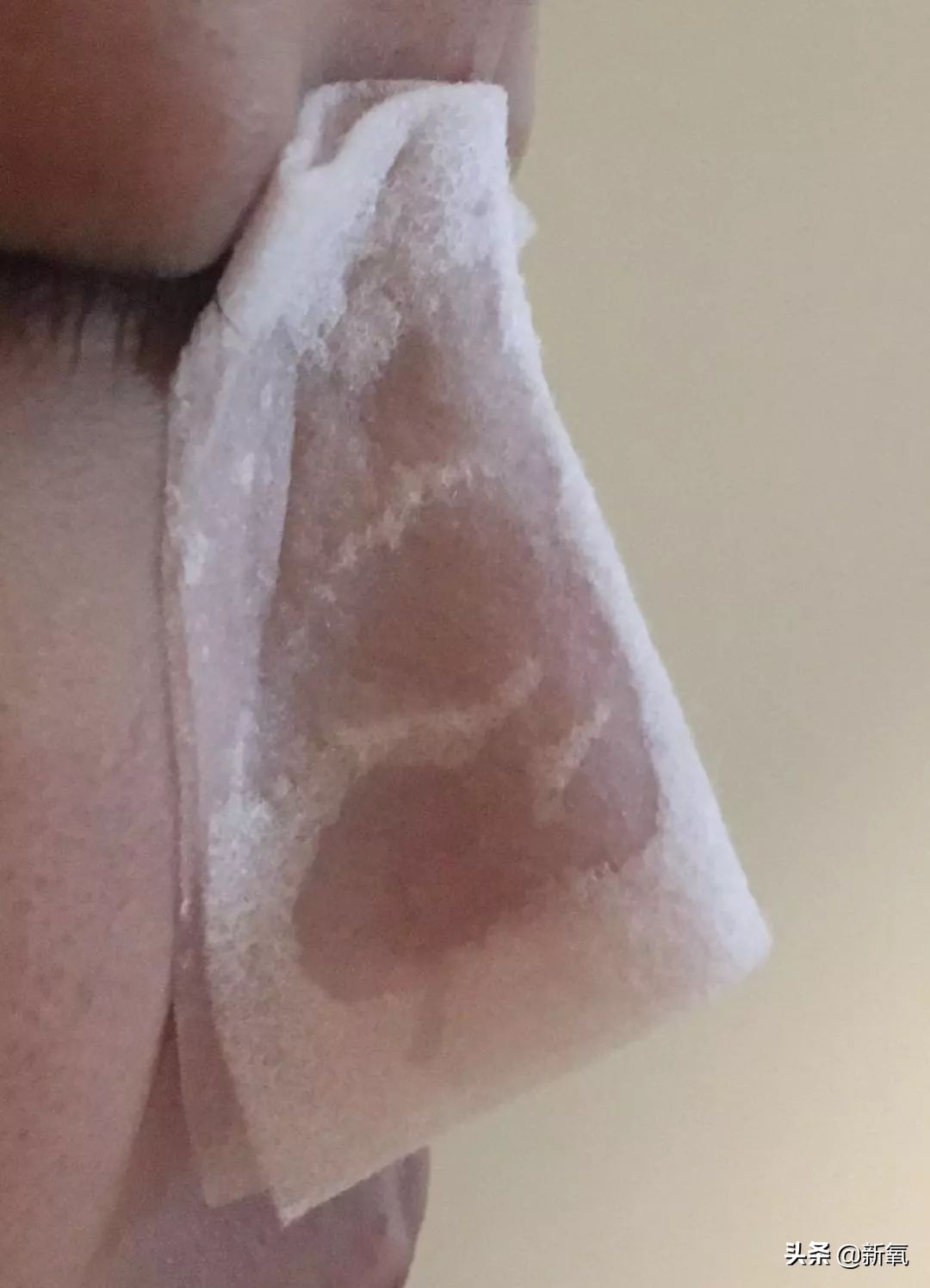 五分钟教你有效去黑头,最火去黑头收缩毛孔