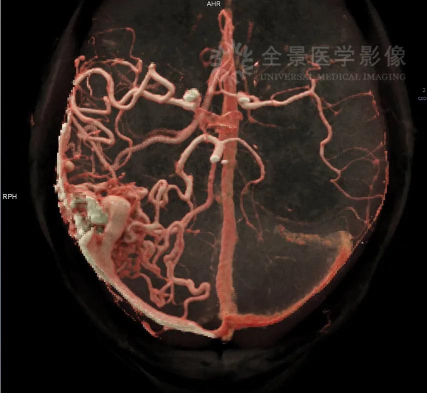 颈部肿块为什么有80%是肿瘤,颈部肿块1年没有变化