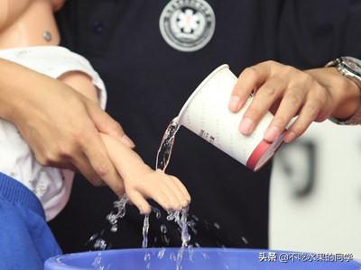 被宠物猫咬伤出血要打狂犬疫苗吗,宝宝被宠物咬伤时的紧急处理方法