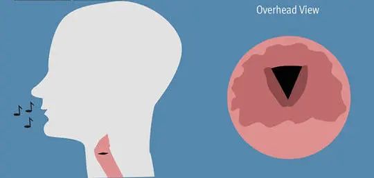 孩子嗓子坏了为什么不疼,孩子嗓子哑了要不要吃消炎药