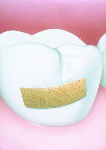 外伤造成牙齿松动多久可以恢复,4岁牙齿外伤轻微松动怎么办