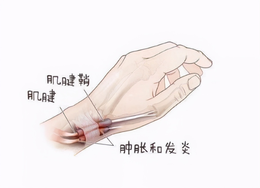 生孩子直接衰老11岁?产后衰老主要体现在哪些方面?如何应对?