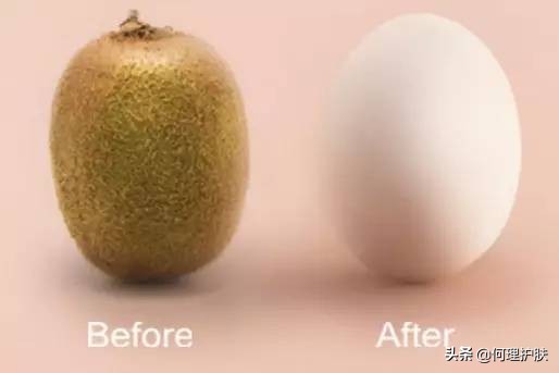 激光脱毛能永久吗脸上,激光脱毛能永久吗知乎