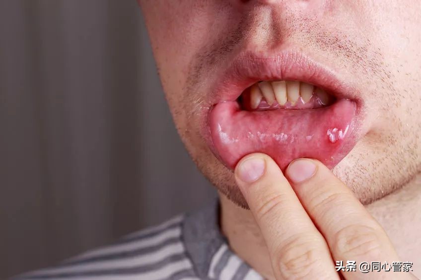 冠心病吃药了胃疼需要停药吗,胃溃疡可以服用冠心病的药吗