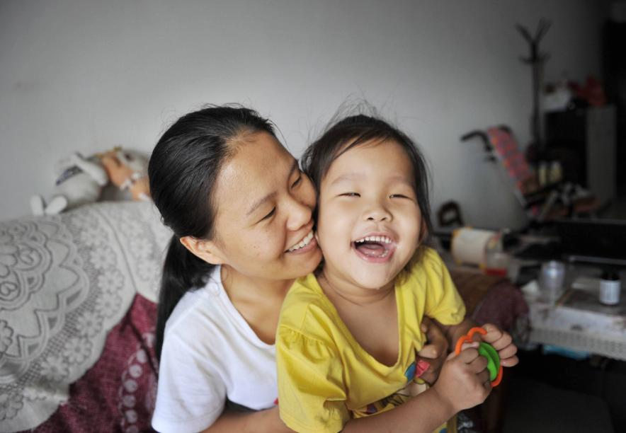 小胖威利症面容表现,小胖威利综合症是几岁开始胖的