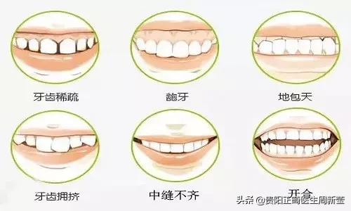 牙齿不好怪父母,儿童口腔不良习惯及矫正