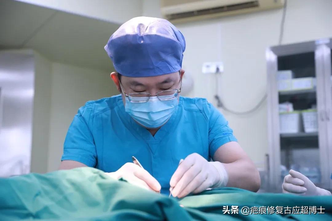 瘢痕疙瘩手术加放疗复发几率,瘢痕疙瘩手术百分百复发吗