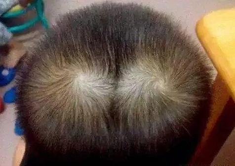 孩子头顶有两个旋性格,男孩头顶两个旋迷信说法