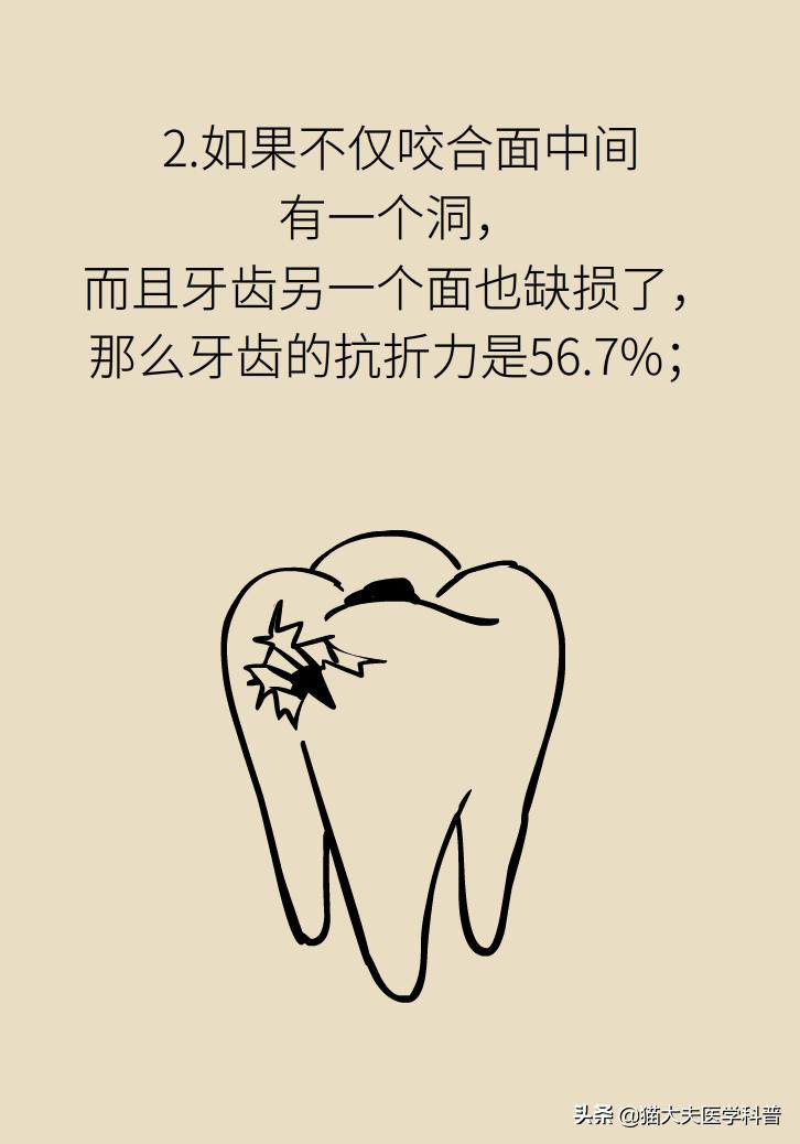 杀死牙神经变成死牙了吗,杀牙神经到底好不好