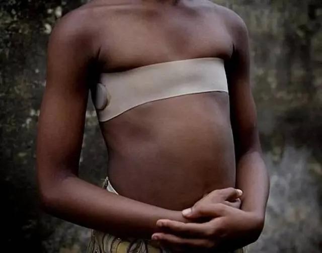 割礼，烫胸，还有哪些让人极思细恐的陋习！