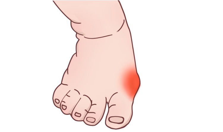 宝宝的鞋子怎么选不伤脚,宝宝的鞋怎么穿