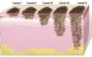 防晒丸是智商税吗,网红防晒喷雾有危害吗