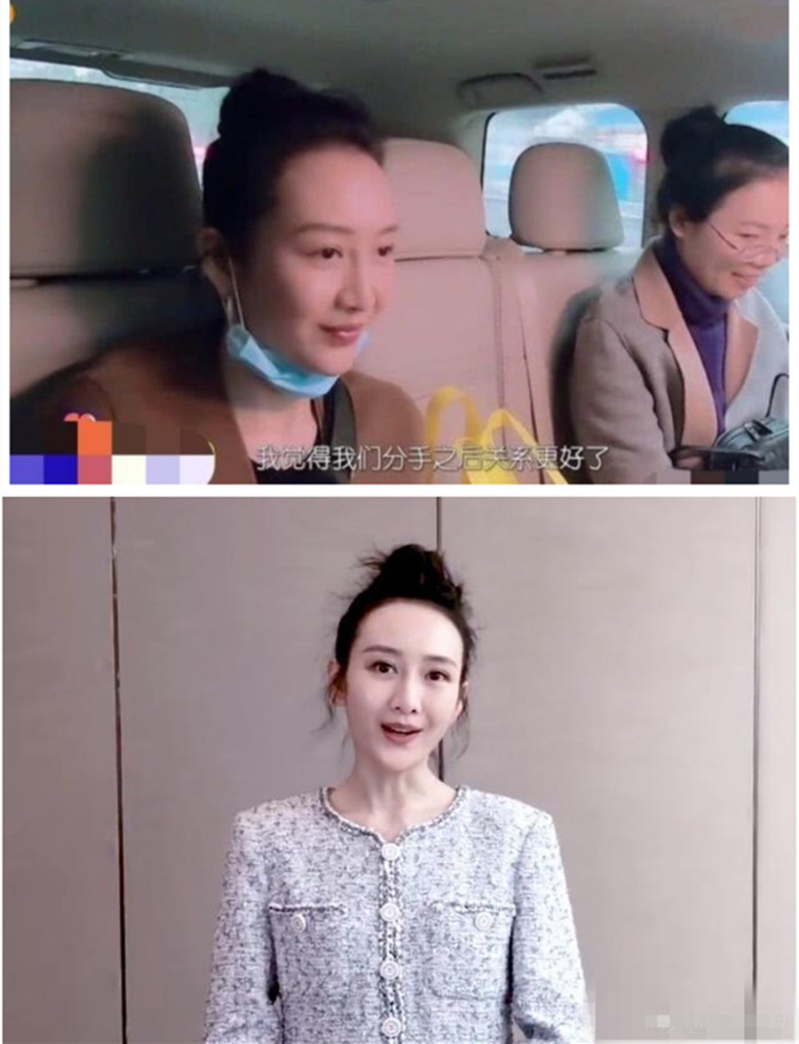 王鸥杨幂发际线,王鸥的发际线真好看