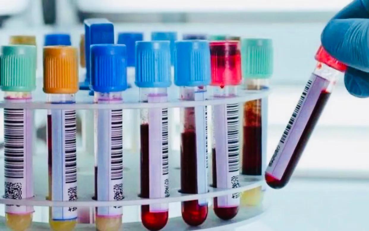 怀孕流血但还是一直有孕吐,早孕有什么方法自然流出来